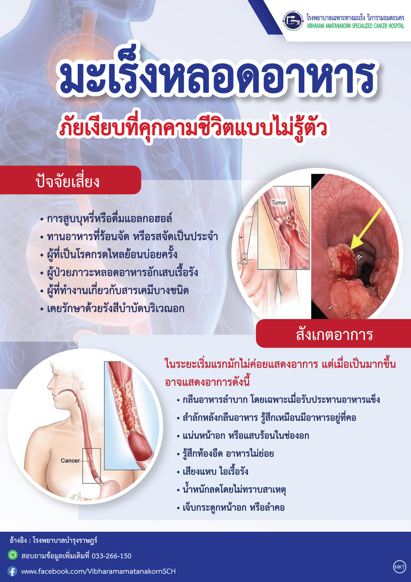 มะเร็งหลอดอาหาร ภัยเงียบที่คุกคามชีวิตแบบไม่รู้ตัว